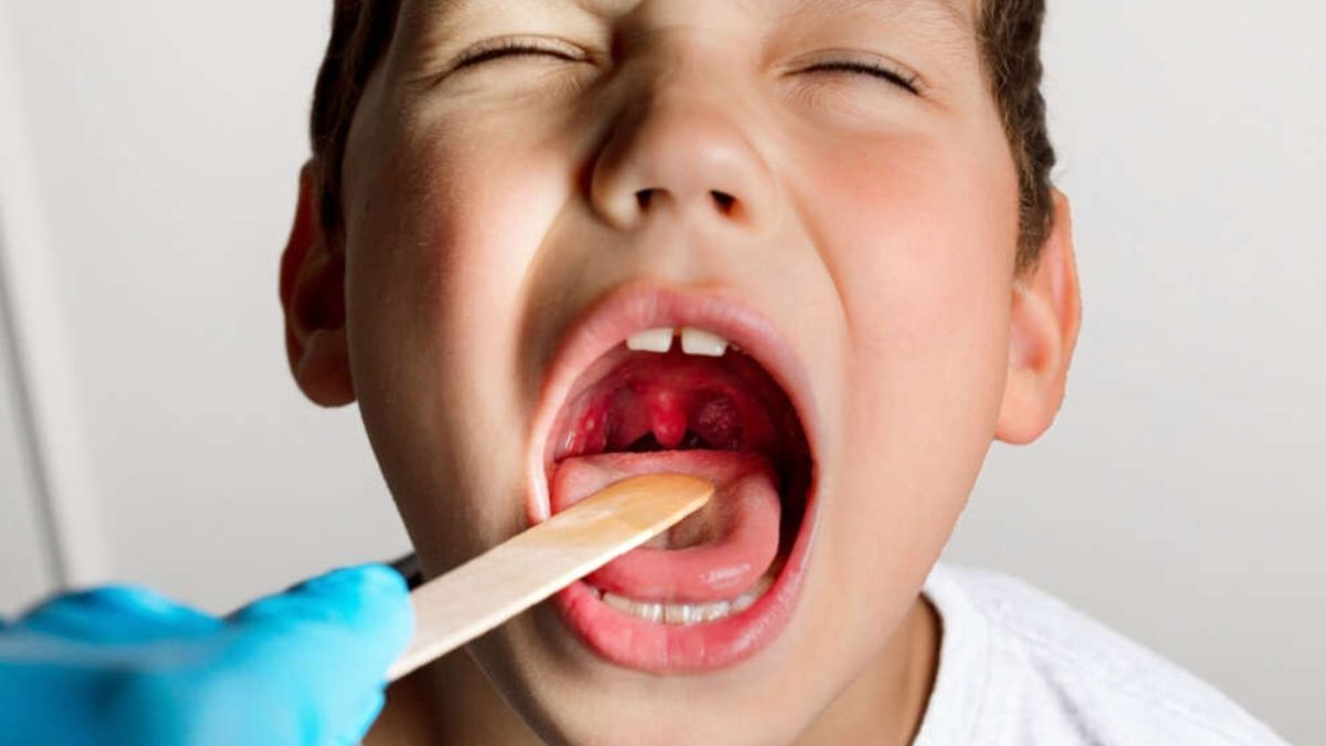 Allarme streptococco tra i bambini: “Mancano gli antibiotici, raddoppiate le infezioni