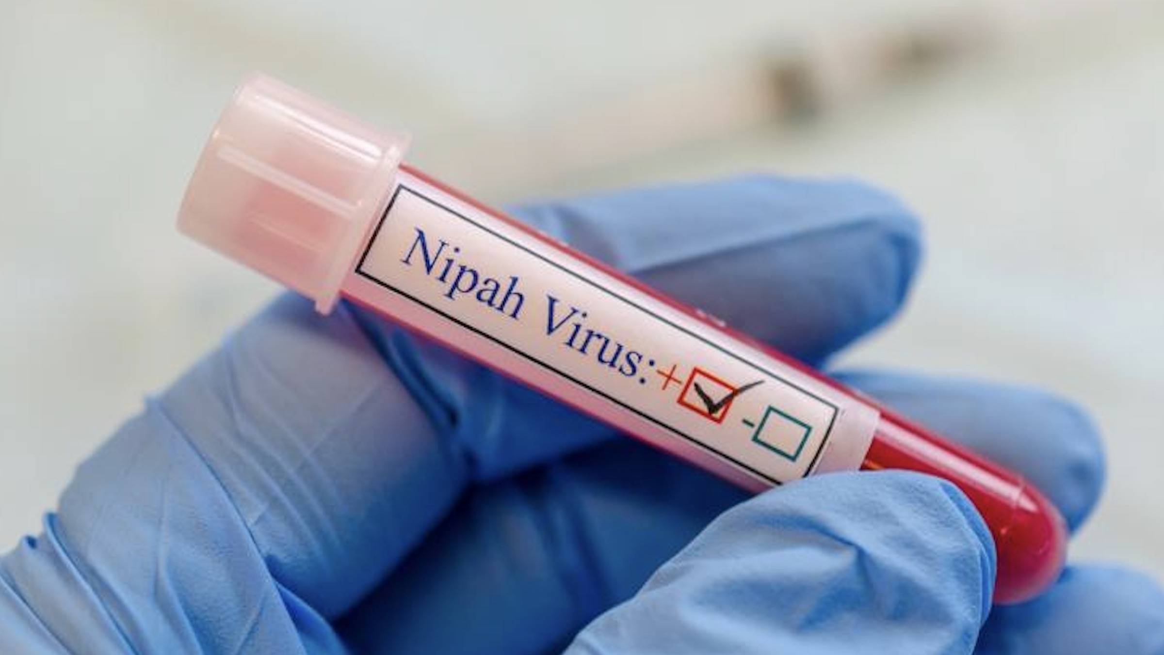 Cos’è il virus Nipah, i sintomi e come si trasmette l’infezione che ha messo in allarme l’India