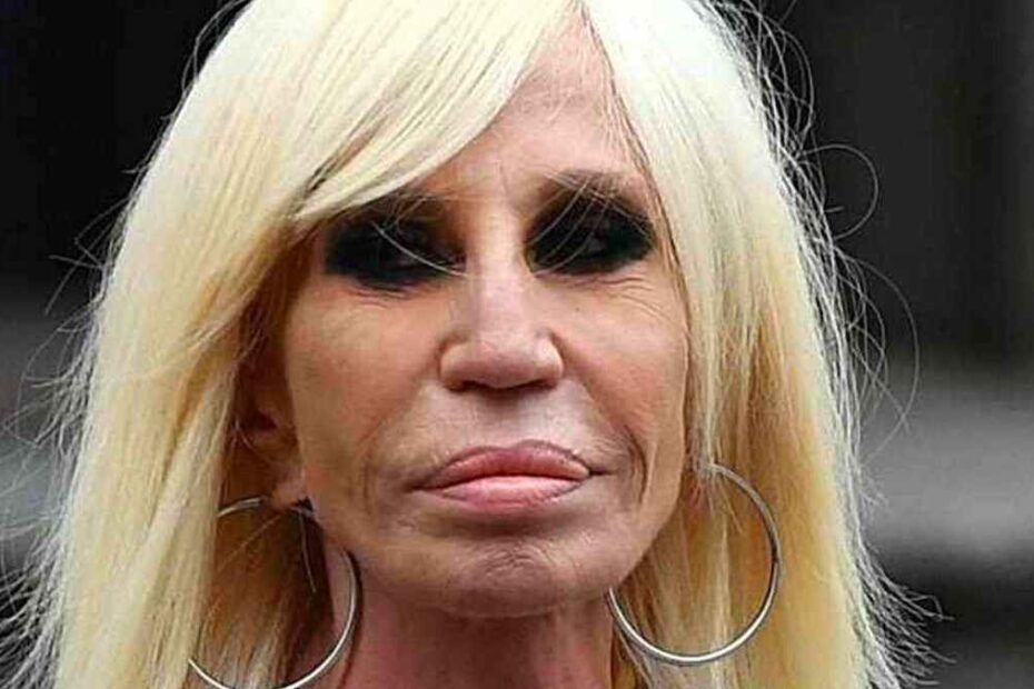 “Le hanno cambiato la faccia”. Donatella Versace, trasformazione shock dopo il nuovo ritocchino