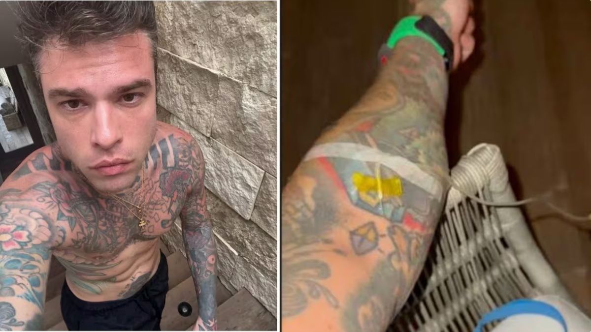 Fedez e la flebo prima del party di Capodanno: cos’è la Vitamin Drip, a cosa serve e perché è così amata dai vip